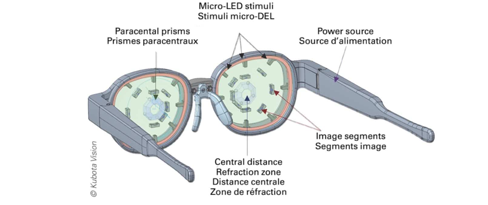 Illustration of the Kubota Glass device, developed for managing childhood myopia. The device looks like a large, thick rimmed and thick-lensed pair of glasses. Labeled parts include the Paracental prisms, Micro-LED stimuli, Power source, Image segments, and Central distance refraction zone. There are also labels in French.